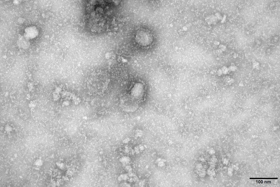 Número total de mortes em decorrência do coronavírus ultrapassa 360 Número total de mortes em decorrência do coronavírus ultrapassa 360