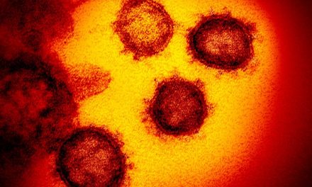Homem testa positivo para coronavírus em SP; caso foi para contraprova