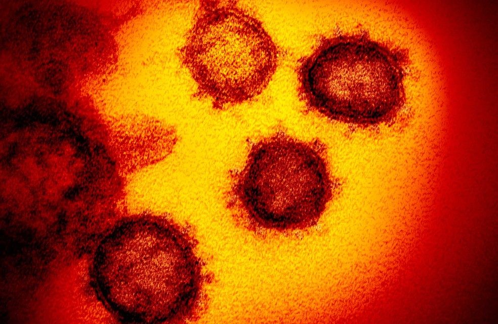 Homem testa positivo para coronavírus em SP; caso foi para contraprova