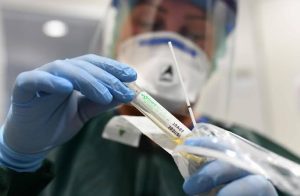 Coronavírus: sobe para nove o número de casos confirmados em Goiás