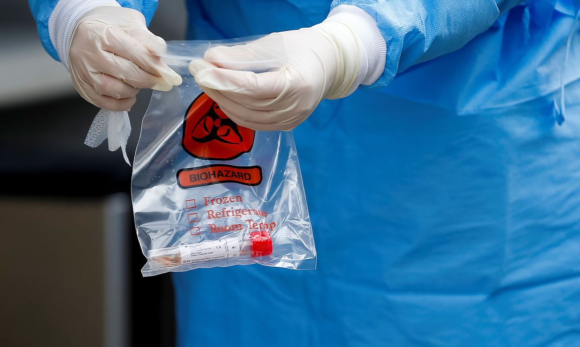 Covid-19: 500 mil kits de teste rápido chegam ao Brasil Covid-19: 500 mil kits de teste rápido chegam ao Brasil