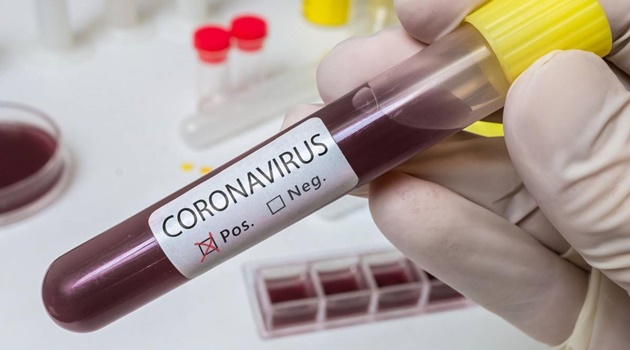 Goiás tem 73 infectados pelo coronavírus e 7 mortes em investigação; Brasil registra 6.836 casos