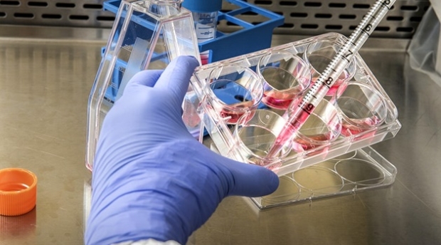 Goiás tem cinco mortes por Covid-19 e quatro sob investigação Goiás tem cinco mortes por Covid-19 e quatro sob investigação