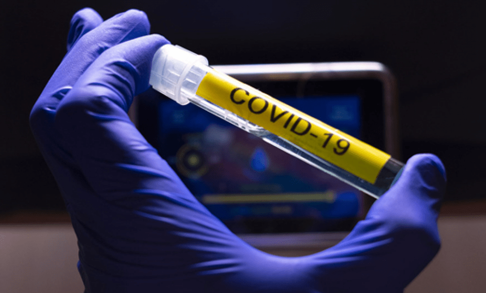 Goiás tem 363 mortes e 18.926 casos confirmados de coronavírus