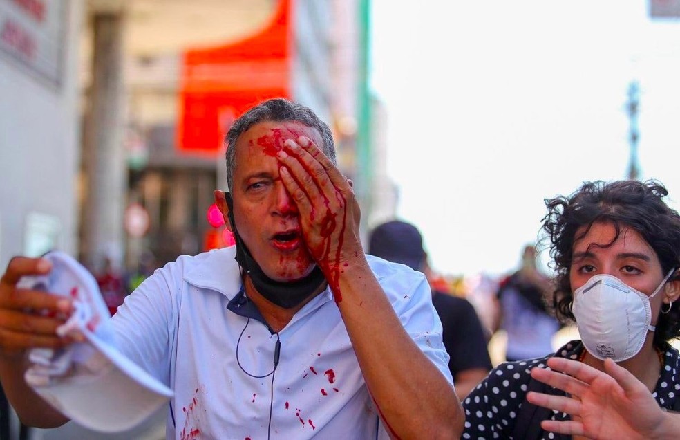 Homem que perdeu olho após ação da PM em protesto no Recife deixa hospital