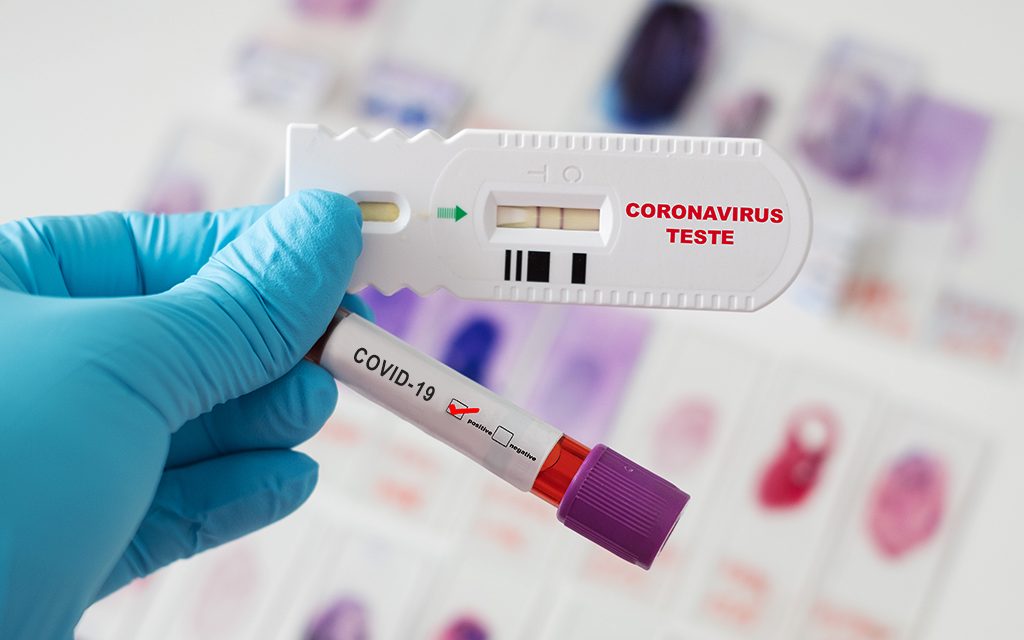 Covid-19: anticorpos podem durar até 12 meses após infecção, diz estudo chinês