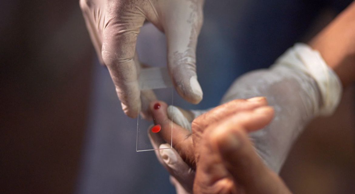 Ministério da Saúde quer zerar casos de malária no país até 2035