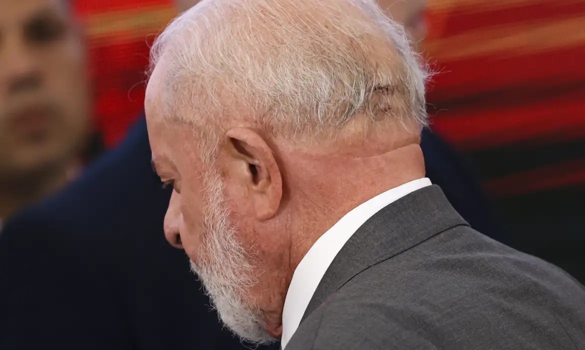 Lula fará novo procedimento cirúrgico nesta quinta