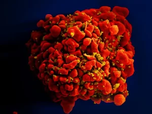 HIV: dois novos casos de cura são anunciados; total chega a 13
