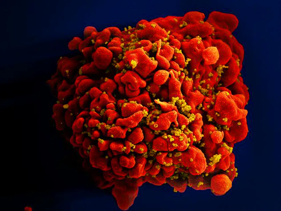 HIV: dois novos casos de cura são anunciados; total chega a 13 HIV: dois novos casos de cura são anunciados; total chega a 13
